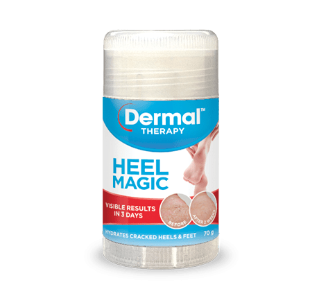 Dermal Therapy Heel Magic 70gm - Dermal Therapy - 1 - Beauty & Essentials - ThePharmacy