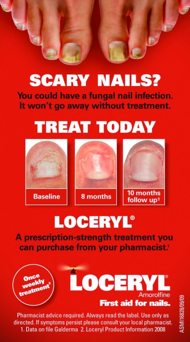 Loceryl Nail Lacquer Kit - Loceryl - 1 - Prescriptions - ThePharmacy
