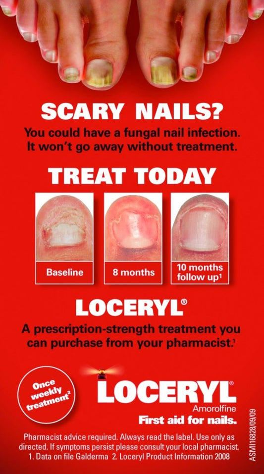 Loceryl Nail Lacquer Kit - ThePharmacy