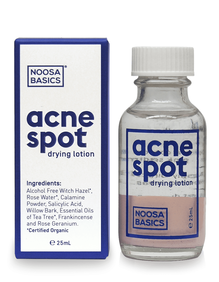 Noosa Basics Acne Spot Drying Lotion 25mL - Noosa Basics - 1 - Beauty & Essentials - ThePharmacy